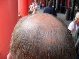Mr D9's Bald Spot!