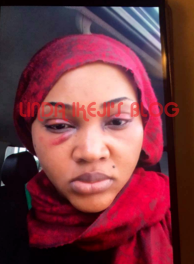 4 LIB Exclusive: Mercy Aigbe's 7-year marriage to Lanre Gentry crashes over alleged battering. See her battered face (photos)