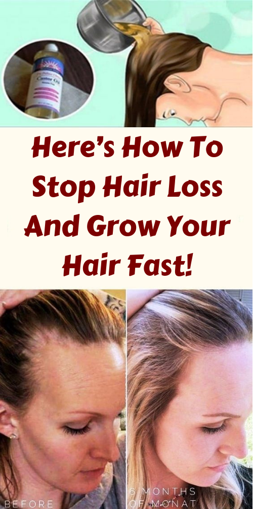 Here’s How To Stop Hair Loss And Grow Your Hair Fast! Natural Health