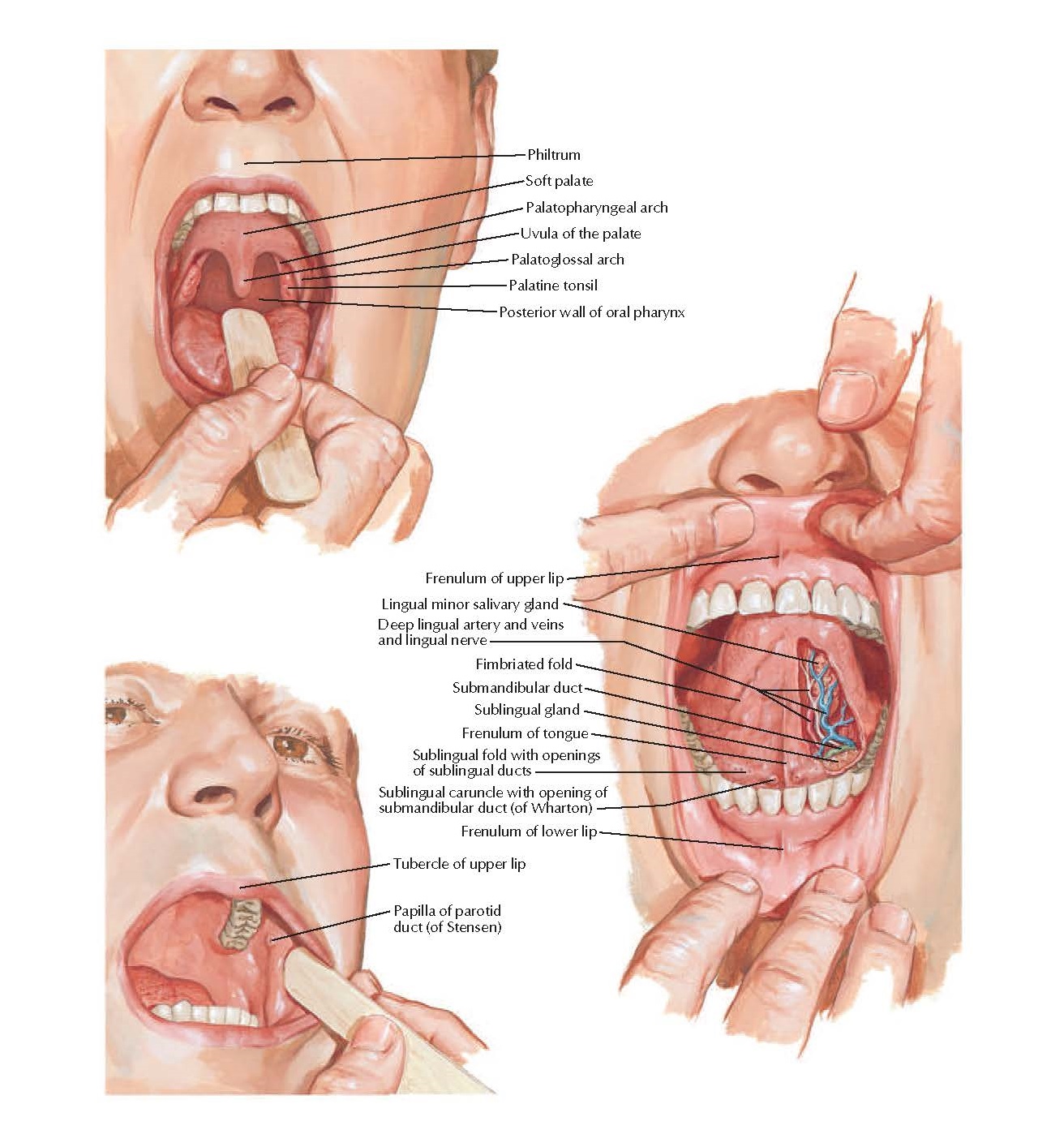 Fimbriated fold of tongue pain