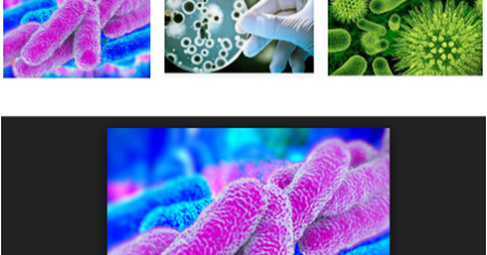 Contoh Peran 8 Bakteri Menguntungkan dan Merugikan Bagi Kehidupan Manusia