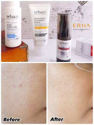 review-produk-perawatan-kulit-dari-erha-dermatology.jpg review-produk-perawatan-kulit-dari-erha-dermatology.jpg
