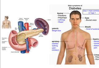 Cara Mudah Sembuhkan Penyakit Diabetes - 12 Tips Sehat Agar Terhindar Dari Penyakit Diabetes / Kencing manis