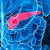 Any Treatment Available for 4th Stage of Pancreatic Cancer in India?