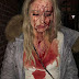 Девушке разбили голову бутылкой за то, что она не дала облапать себя в клубе(ФОТО 18+)