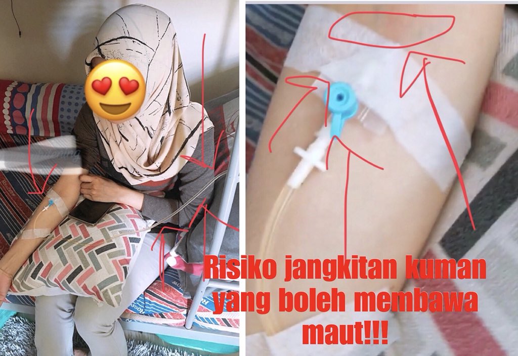 "Jangkitan kuman melalui prosedur injeksi IV" - Dr. Rafidah