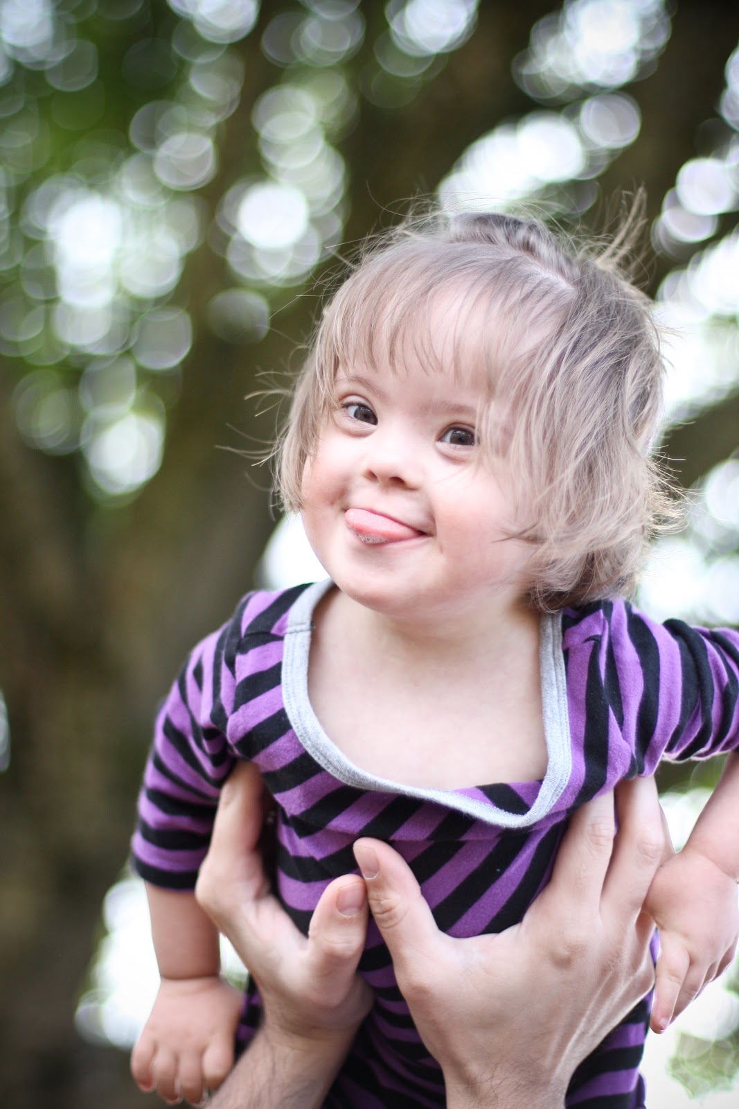 Human Adoption & Choosing Down Syndrome (Day 3)