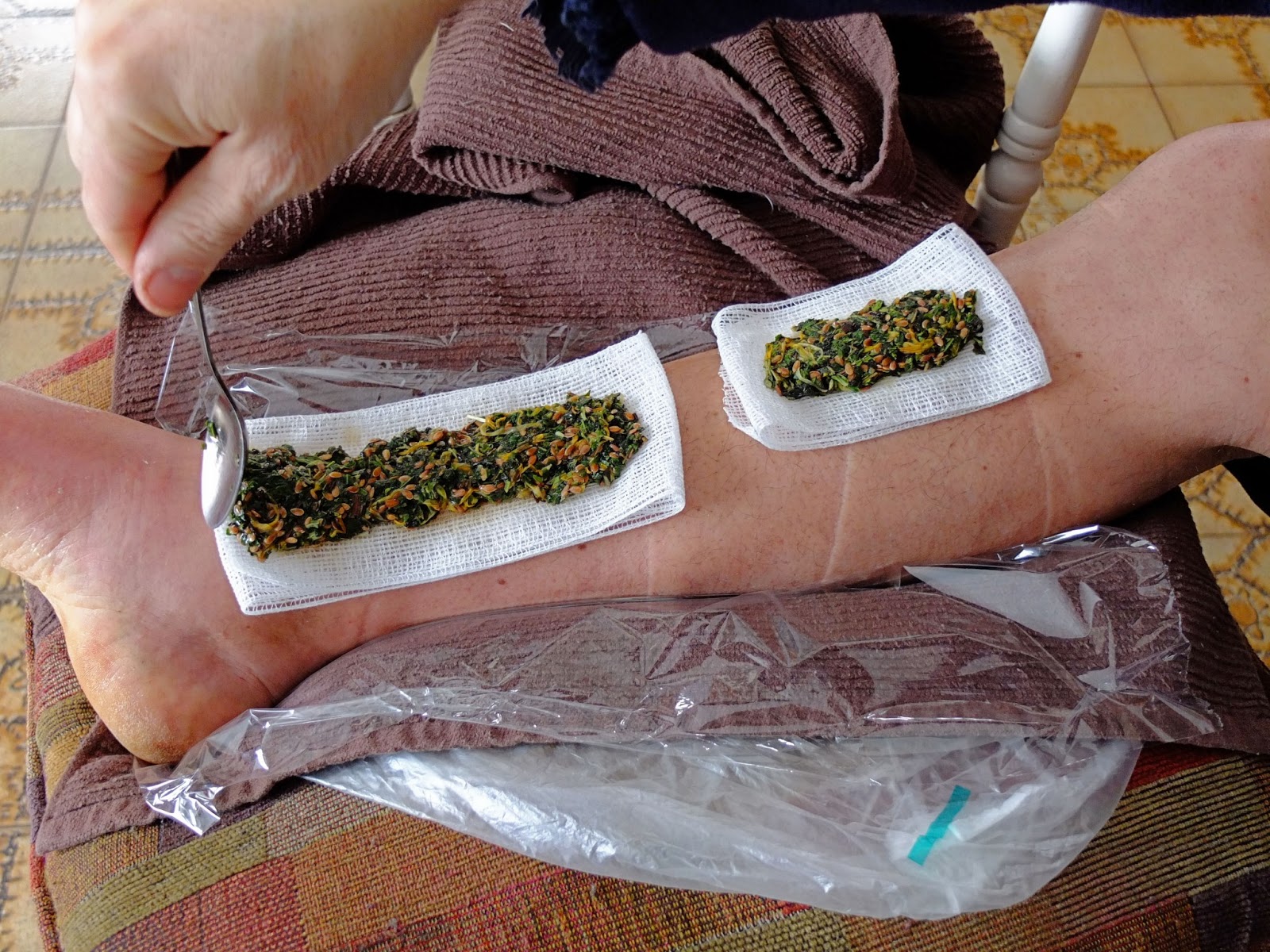 Being Herbalism Applying a Poultice