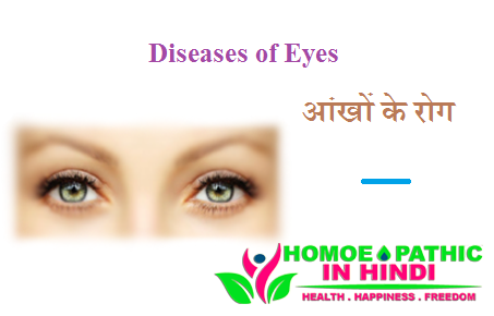 Diseases of Eyes - आंखों के रोग