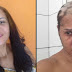Cabeleireira fica careca após alisamento e pede ajuda