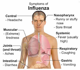Symtomps of influenza