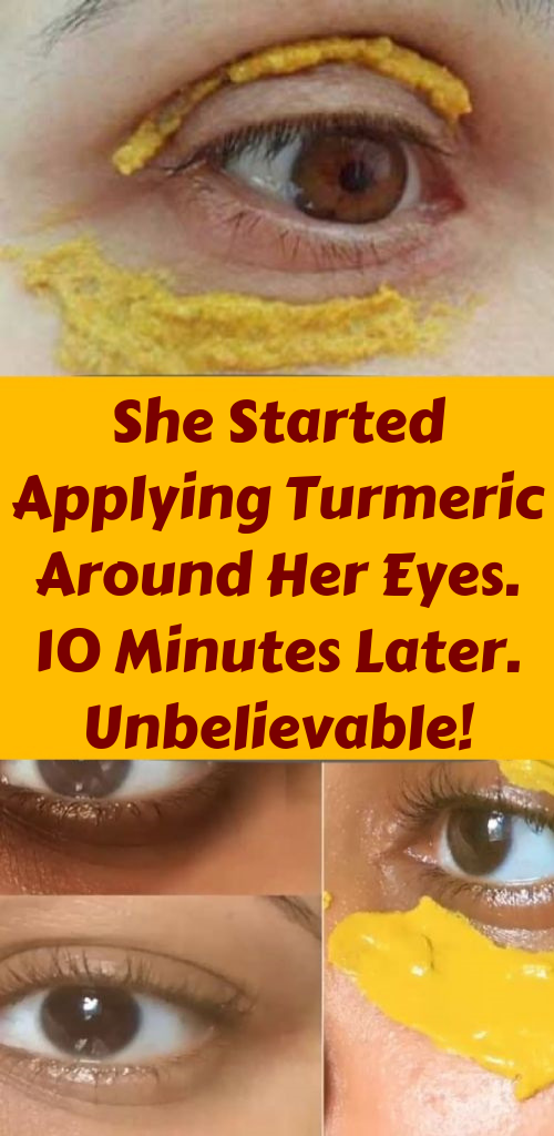 Let Start Slim Today She Started Applying Turmeric Around Her Eyes. 10