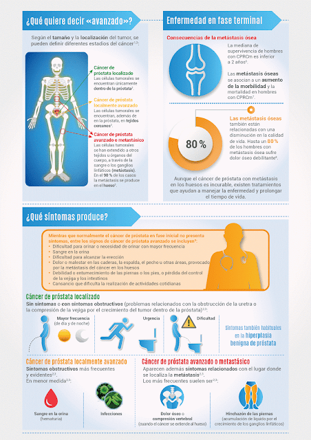 ¿Cuánto tiempo puede vivir con cáncer de próstata avanzado?