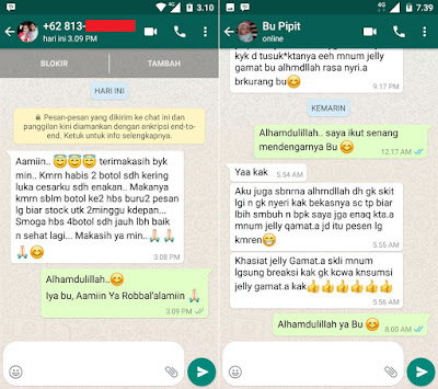 Cara Mengatasi Puting Payudara Lecet Dan Bernanah Secara Alami Cara Mengatasi Puting Payudara Lecet Dan Bernanah Secara Alami