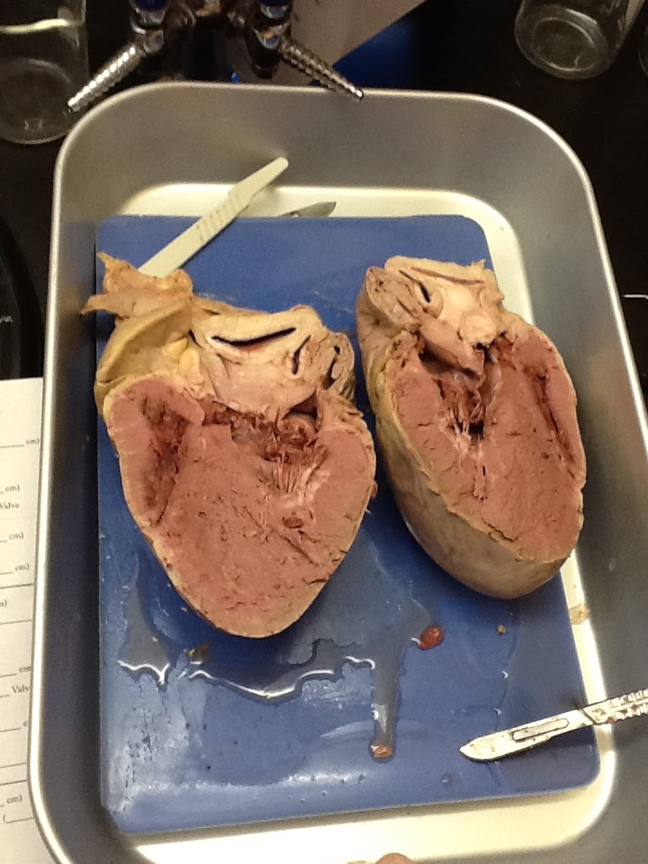 ANATOMY!!!! : ): Pig Heart Dissection!