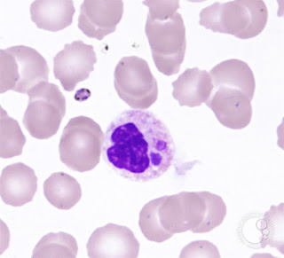 Erlihija u mikroskopskom nalazu krvi - Panvet dežurna veterinarska stanica Subotica