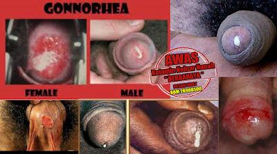 Obat Tradisional Kencing Sakit Keluar Nanah Dan Darah Obat Tradisional Kencing Sakit Keluar Nanah Dan Darah