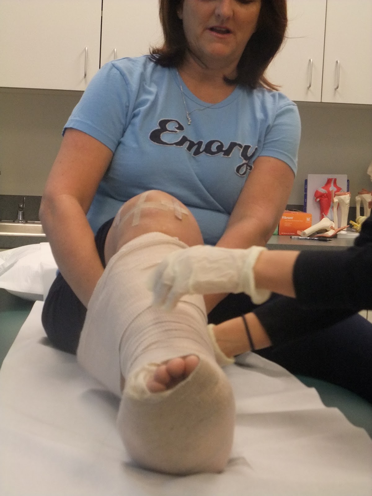 Ankle surgery adventure Cast on and good news!