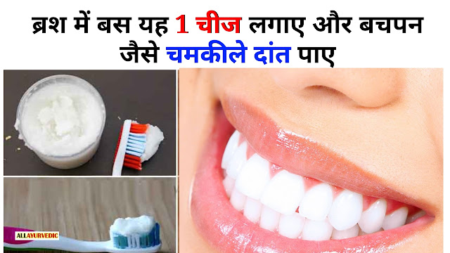 ब्रश में बस यह 1 चीज लगाए और बचपन जैसे चमकीले दांत पाए - All Ayurvedic