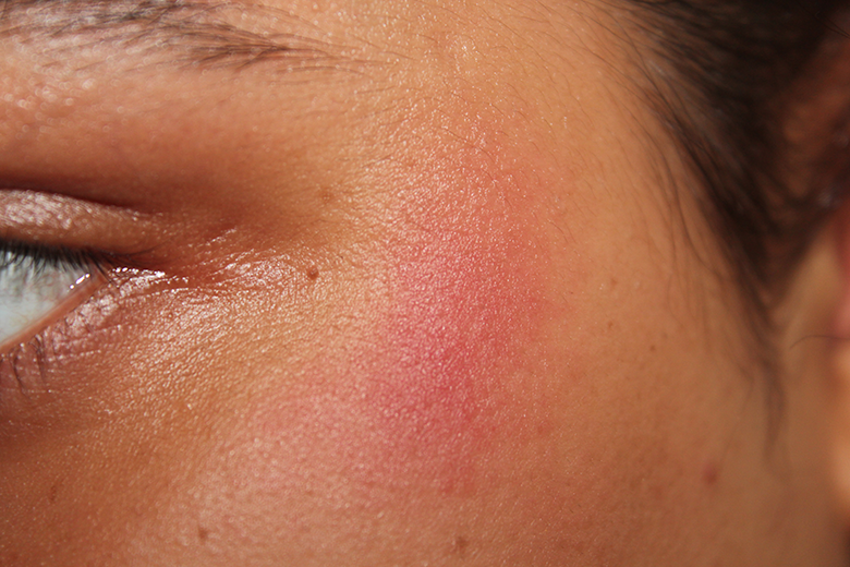 Burned by a Toner — Dolce Vanity