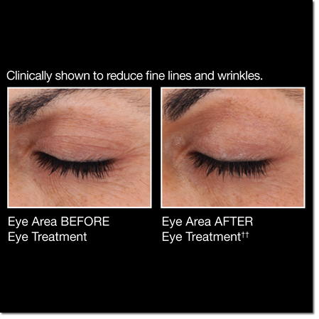 avon anew genics eye treatment