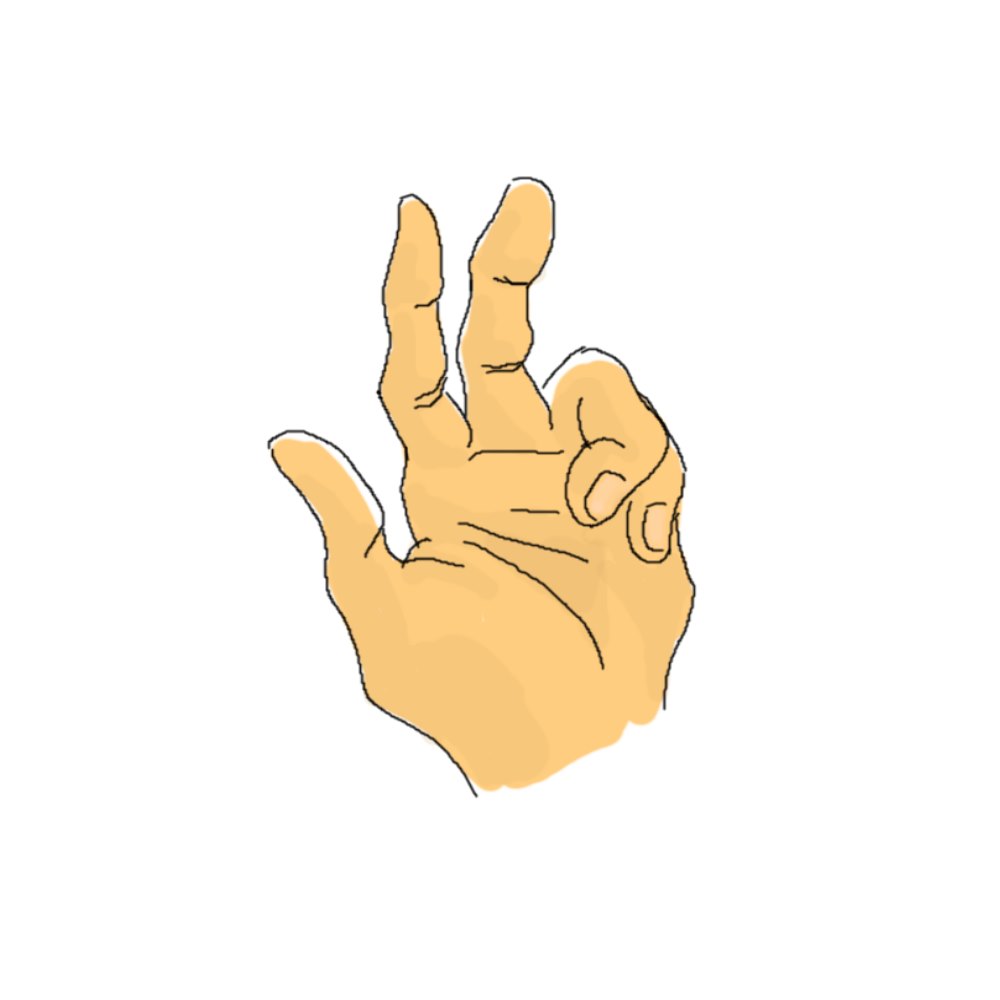 Mano mediano de nervio del pdf lesion predicador