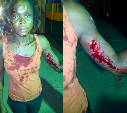aa Photos: Couple arrested in Lekki for stabbing their neighbours with broken bottle