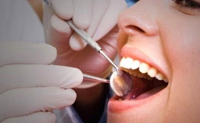 How To Know If You Have A Cavity, Recognize and Medical Aid