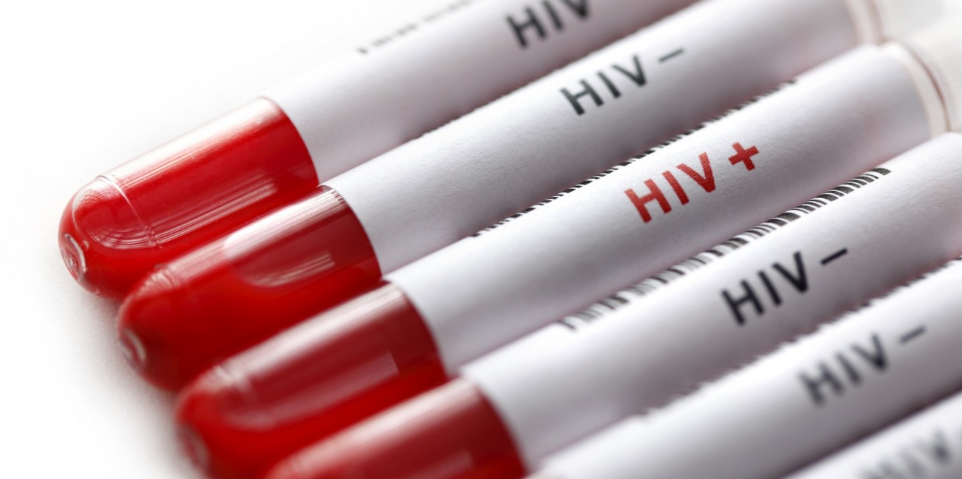 Selain HIV/ AIDS, Ternyata Ini Jenis Penyakit Tidak Bisa Disembuhkan