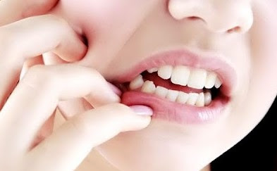 15 Cara Menyembuhkan Sakit Gigi Paling Ampuh