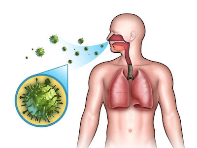Is viral bronchitis contagious?
