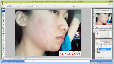 Tips Menghilangkan Jerawat Menggunakan Photoshop