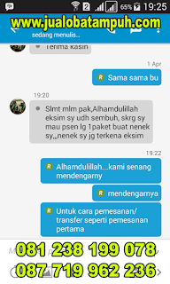 Bagaimana Cara Menyembuhkan Penyakit Eksim Menahun Bagaimana Cara Menyembuhkan Penyakit Eksim Menahun