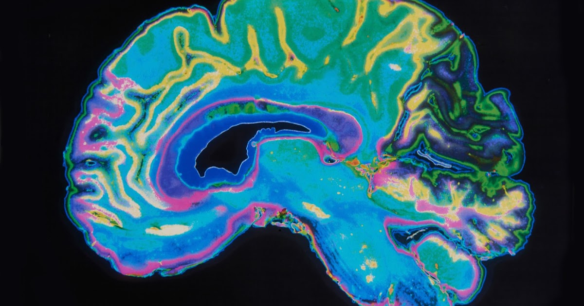 Psych News Alert Targeted Deep Brain Stimulation May