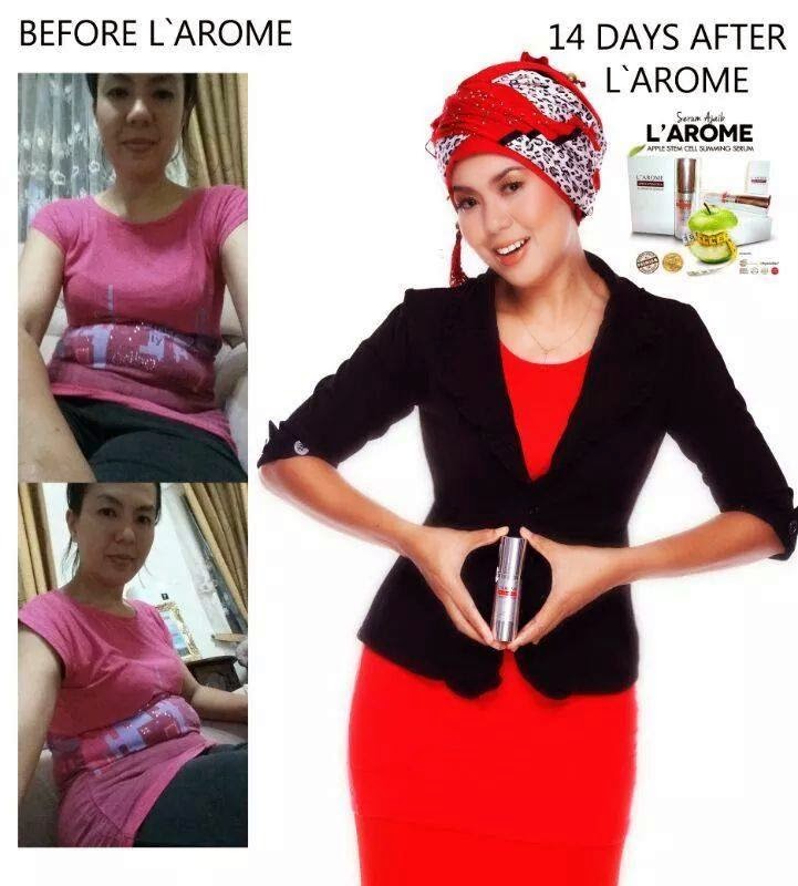 Testimoni L'arome Slimming Serum Testimoni L'arome Slimming Serum