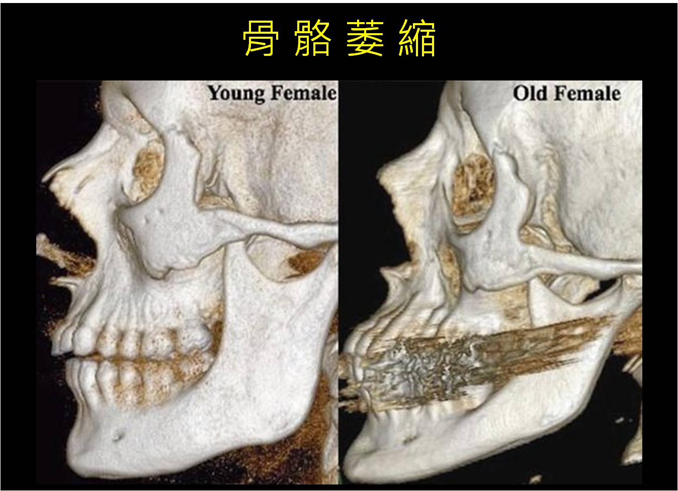 up雷射費用up雷射價格up雷射台北up雷射痛up雷射痘疤up雷射修復期凹疤修復凹疤藥膏凹疤ptt凹疤雷射凹洞治療費用植凹疤蜂巢皮秒凹疤臉上凹洞怎麼辦痘疤凹洞價錢痘疤凹洞消除痘疤消除痘疤淡化痘疤黑色素沉澱痘疤保養品去痘疤產品痘疤ptt痘疤藥膏紅痘疤怎麼消黑色痘疤色素痘疤皮秒雷射皮秒q雷射皮秒雷射原理pico q蜂巢皮秒比較pico q pttdiscovery picopico q價格蜂巢皮秒雷射皮秒雷射心得副作用皮秒雷射心得皮秒雷射ptt皮秒雷射毛孔皮秒雷射術後皮秒雷射多久打一次皮秒雷射推薦皮秒雷射恢復期皮秒雷射原理探索皮秒雷射價格埋線原理埋線價格埋線減肥副作用埋線減肥後遺症埋線ptt埋線減肥日記埋線痛埋線運動埋線減肥失敗埋線拉提失敗埋線拉提後遺症埋線拉提ptt埋線拉提推薦埋線拉提價格埋線拉提副作用埋線拉提術後臉部埋線拉提費用埋線拉提恢復期台北埋線拉提推薦玻尿酸副作用玻尿酸是麼玻尿酸作用玻尿酸價格玻尿酸功效玻尿酸保養玻尿酸品牌玻尿酸成分玻尿酸吃的玻尿酸口服電波拉皮價錢電波拉皮副作用電波拉皮效果電波拉皮ptt電波拉皮推薦黃金電波拉皮價格電波拉皮痛電波拉皮1200發電波拉皮音波拉皮電波拉皮效果多久音波拉皮後遺症音波拉皮費用超音波拉皮效果音波拉皮ptt音波拉皮推薦音波拉皮多久有效果音波拉皮500條音波拉皮價格2018音波拉皮術後保養音波拉皮失敗音波拉提價格音波拉提副作用音波拉提ptt音波拉提術後保養音波拉提推薦音波拉提腫音波拉提原理埋線拉提音波拉提維持多久辰星皮膚專科診所評價辰星皮膚專科診所ptt辰星皮膚科ptt辰星皮膚科掛號費辰星皮膚ptt港墘皮膚科內湖皮膚科推薦楊兆傑醫師
