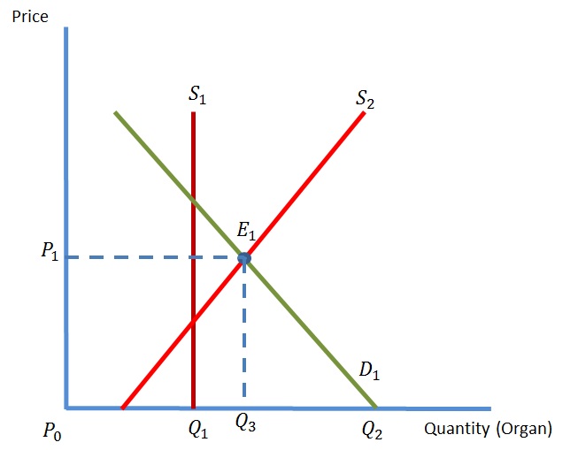 Economists in The Making: Market for Human Organs