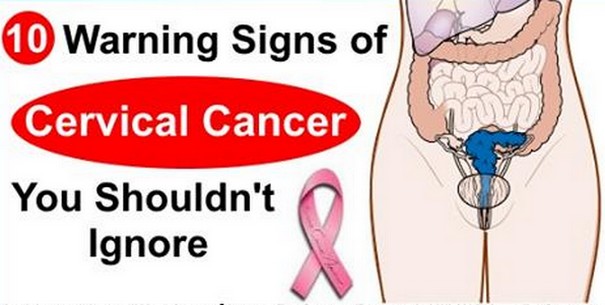 Cervical cancer caused by multiple sex partners Mature swinger creampie