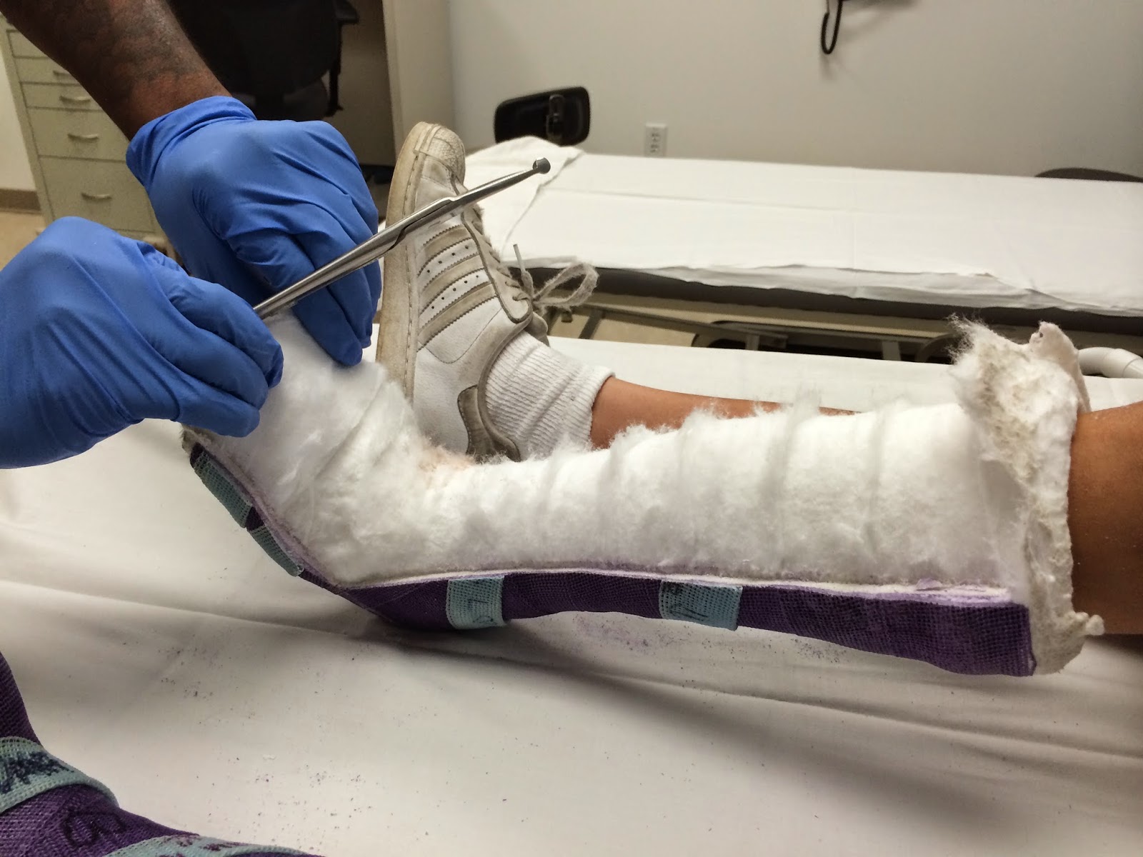 leg shortening surgery nhs