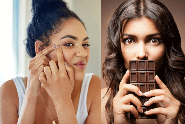 Does Chocolate Cause Acne? What the Science Says? Natural Home