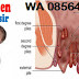 AmbeJOSS Herbal Wasir 50 Kapsul untuk Obat Wasir thumbnail