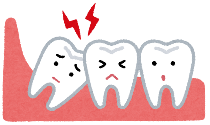 横向きに生えた親知らずのイラスト | かわいいフリー素材集 いらすとや