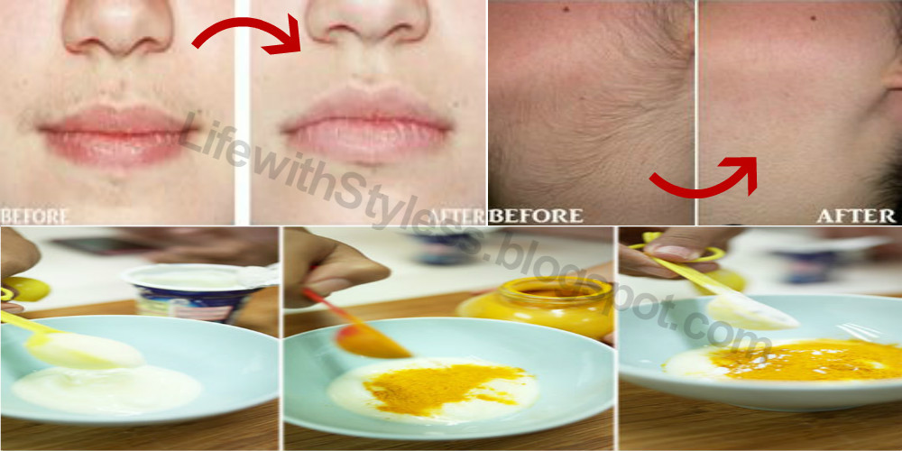 Get Rid Of Unwanted Hair Overnight Prepare Unwanted Hair Removal Mask