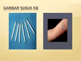 susuk susuk kb