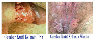 Foto Obat Penyembuh Penyakit Jengger Ayam Ampuh