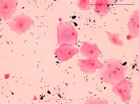 e coli in the vagina how can we make sex