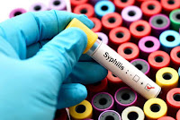 Resep Obat Sipilis dari Dokter yang Tersedia di Apotek