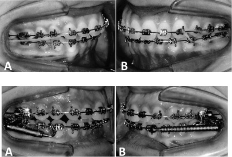 ORTODONTIA CONTEMPORÂNEA Tratamento de pacientes com maloclusão de