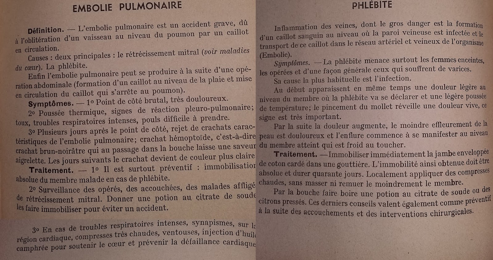 La thrombose des veines profondes le traitement les symptômes de la photo