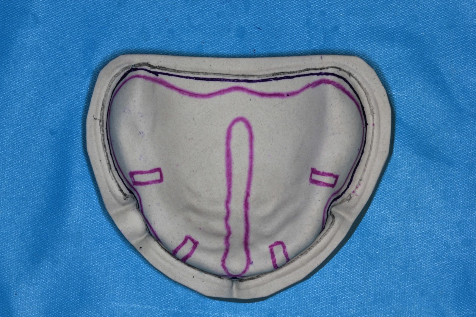 Understanding Prosthodontics Tagore Dental College & HospitalBy Department of Prosthodontics